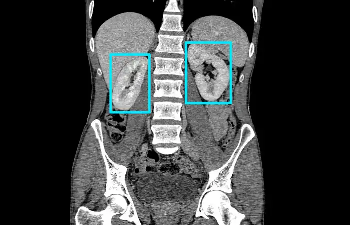 Medical Data Annotation