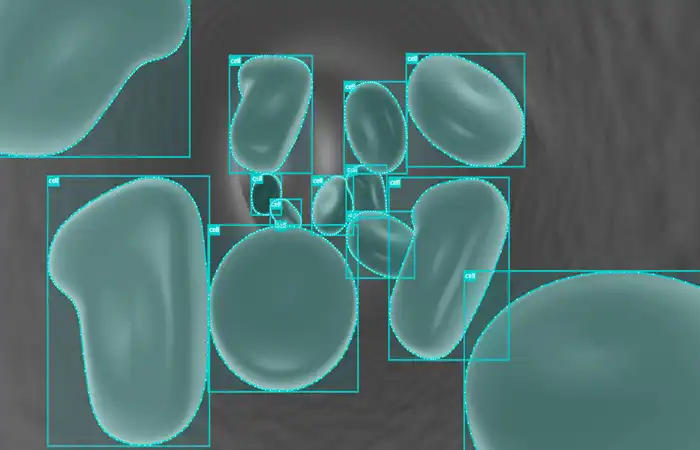 Medical Image Annotation